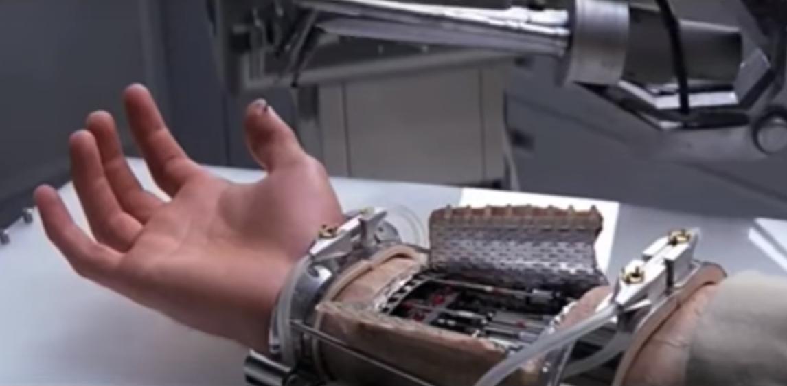 Imagen de la mano biónica implantada a Luke Skywalker