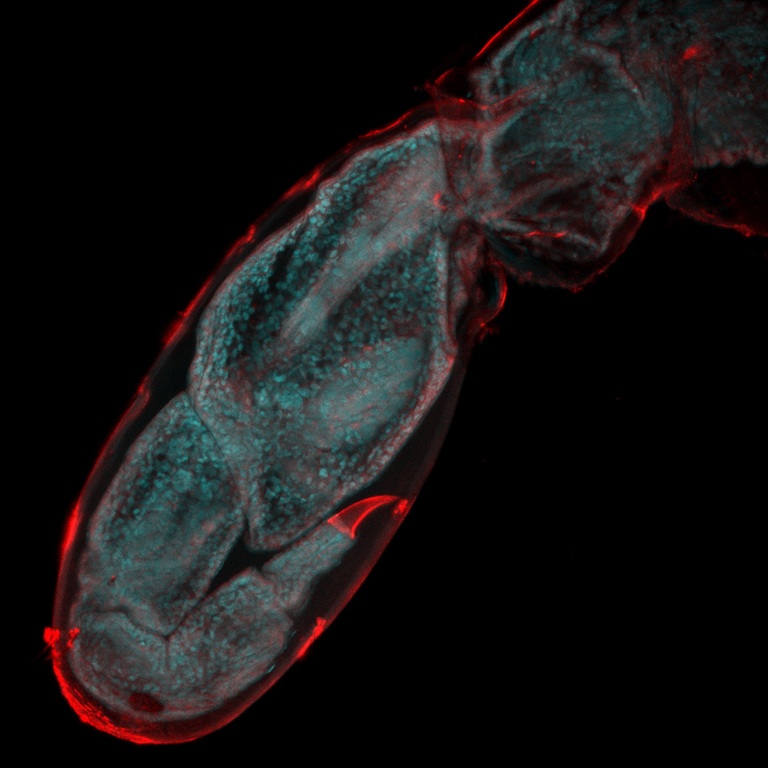 Imagen de la regeneración de una pata en un crustáceo